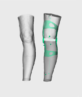 OssKin | Provoke Ligament Knee Brace