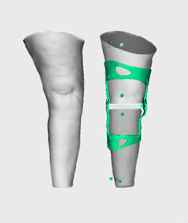 OssKin | Provoke Ligament Knee Brace