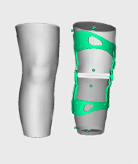 OssKin | Provoke Ligament Knee Brace