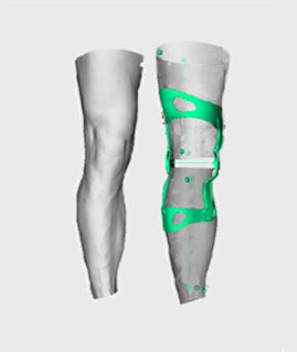 OssKin | Provoke Ligament Knee Brace